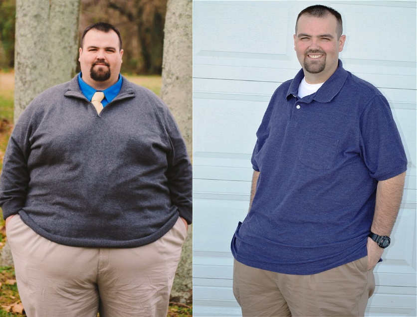 Gastric Sleeve 10 Years Later: All You Need to Know 2023