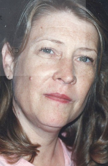 Nancy Hammett Rawlings, 78 (1947&ndash;2026)