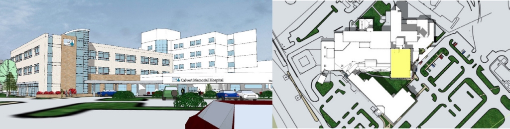 Artist renderings provided by Calvert Memorial Hospital.